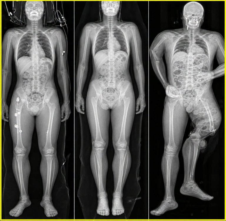 Una imagen de varios estudios médicos generó preocupación, pero el detalle importante estaba fuera de la fotografía