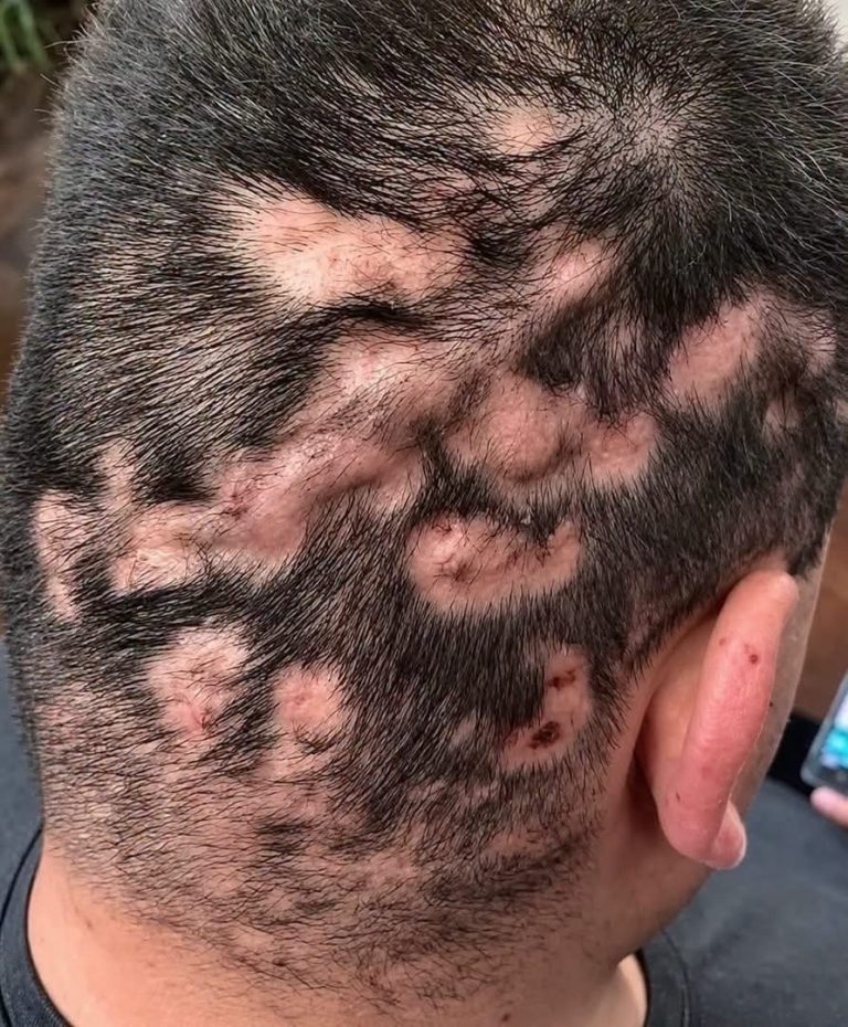 Un barbero notó varios espacios extraños durante un corte y descubrió que el problema estaba en su propia técnica