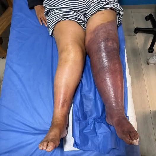 Una mujer encontró una diferencia extraña entre dos fotografías y descubrió que todos estaban mirando el detalle equivocado