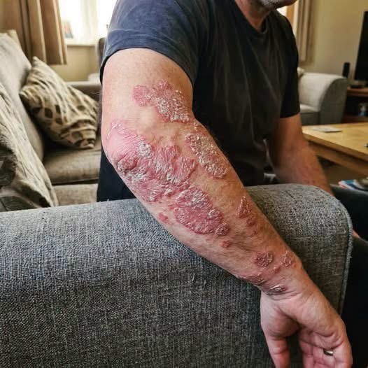 Un hombre culpó a su perro por unas manchas en el sofá hasta descubrir que el problema estaba en otro lugar